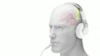 ภาพแอนิเมชั่นของการทำงานของ Neuromodulation