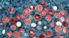 FILE - This image provided by the National Institute of Allergy and Infectious Diseases shows a colorized transmission electron micrograph of mpox particles, red.