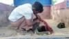 This photo taken on Sept. 17, 2022 shows a young victim of an air strike on a school building in Depeyin township in Myanmar's northwest Sagaing region, a day after an attack on the village by a Myanmar military helicopter.