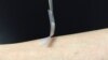 The "smart insulin patch," developed by researchers in the joint UNC/NC State Biomedical Engineering Department. (Credit: The lab of Zhen Gu, Ph.D.)