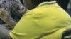An obese person might not only die sooner, but could also experience years of poor health.