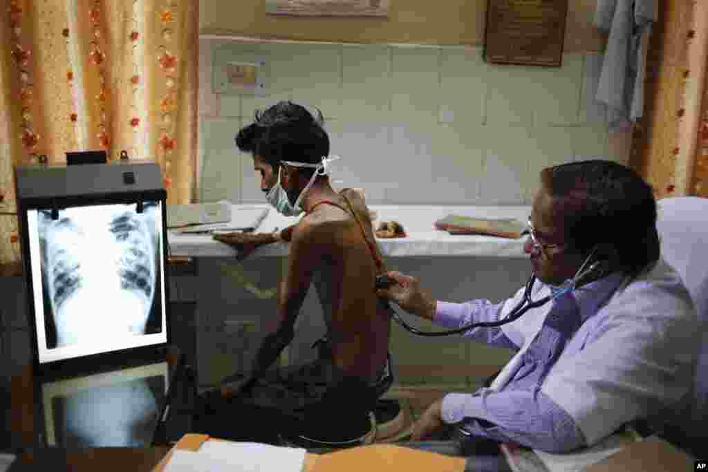 Seorang dokter India memeriksa pasien TB di sebuah rumah sakit di kota Allahabad, India. India mempunyai jumlah penderita TB tertinggi di dunia.&nbsp;