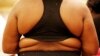 American Medical Association: Obesity is a Disease