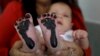 In this May 2, 2019 file photo, Arelys Pulido holds her two-month-old daughter Zuleidys after she had her feet prints taken for her birth certificate at the Erazmo Meoz hospital in Cucuta, on Colombia's border with Venezuela.