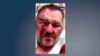 Photo provided by Achille Mayor David Northcutt after attack at a convenience store in March 2019. 